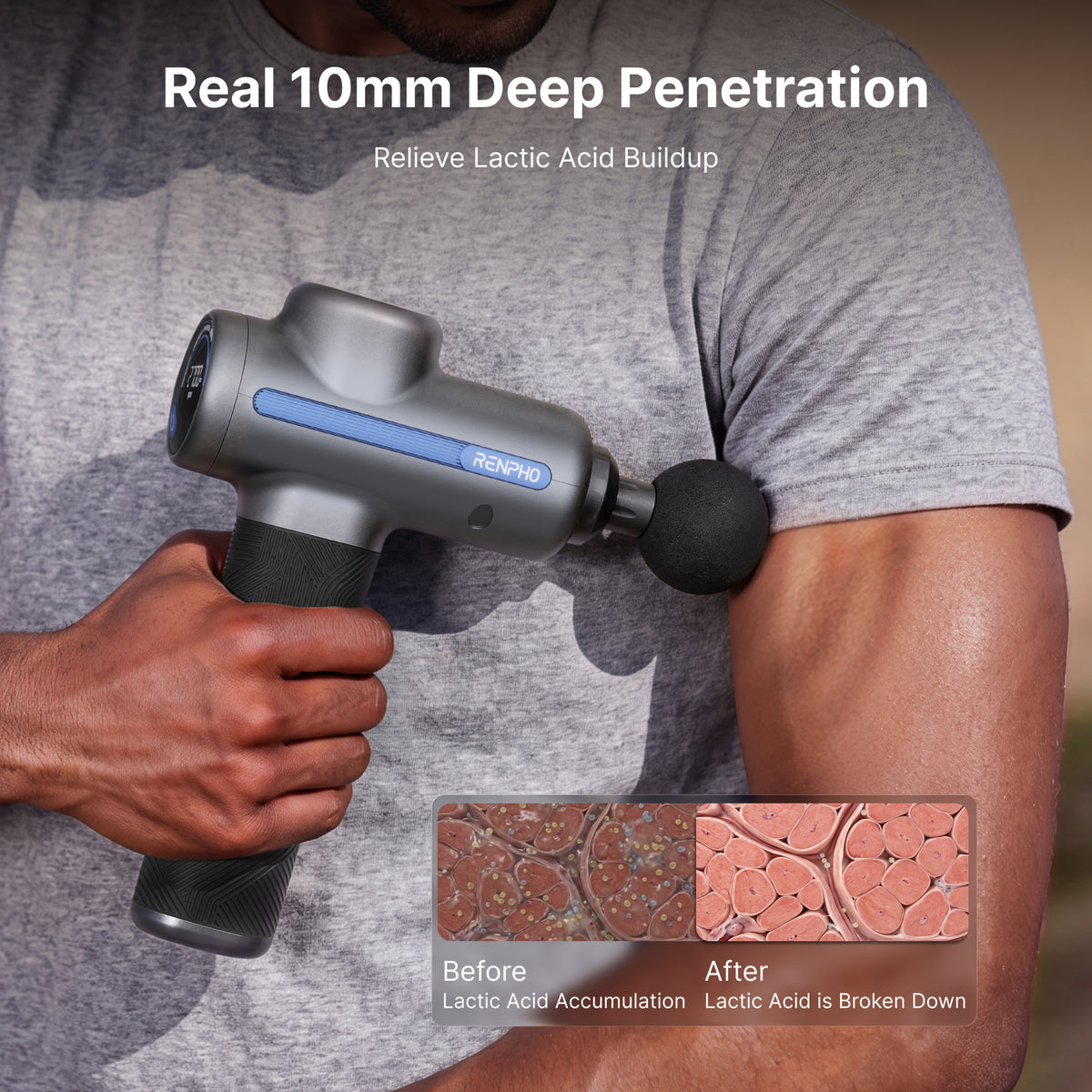 RENPHO Percussion Massage Gun, Handheld Deep Tissue Muscle Massager for Neck Back Shoulder Pain Relief